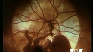 Loi bioéthique : Pour qui, pour quoi ?